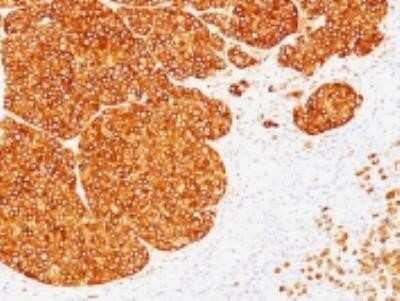 Immunohistochemistry-Paraffin: Tyrosinase Antibody (SPM360) - Azide and BSA Free [NBP2-34770]