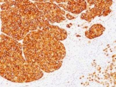 Immunohistochemistry-Paraffin: Tyrosinase Antibody (SPM360) [NBP2-32905]