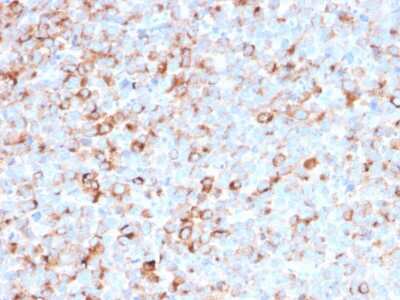 Immunohistochemistry-Paraffin: Tyrosinase Antibody (T311 + OCA1/812) - IHC-Prediluted [NBP2-48119]