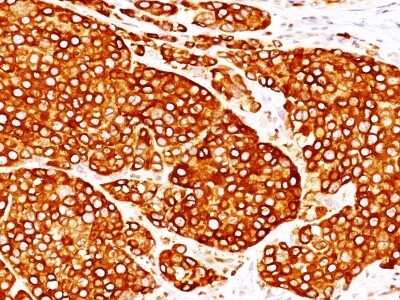 Immunohistochemistry-Paraffin: Tyrosinase Antibody (T311 + OCA1/812) [NBP2-44686]