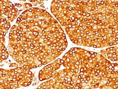 Immunohistochemistry-Paraffin: Tyrosinase Antibody (T311) - Azide and BSA Free [NBP2-33160]