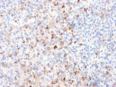 Immunohistochemistry-Paraffin: Tyrosinase Antibody (TYR/2024R) - Azide and BSA Free [NBP3-08892]