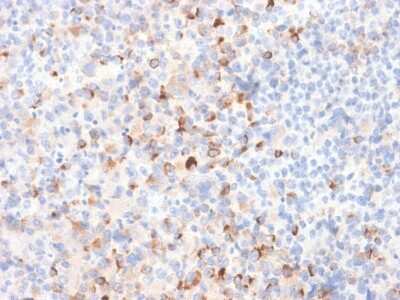 Immunohistochemistry-Paraffin: Tyrosinase Antibody (TYR/2024R) [NBP3-07150]