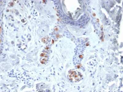 Immunohistochemistry-Paraffin: Tyrosinase Antibody (TYR/3829) [NBP3-07149]