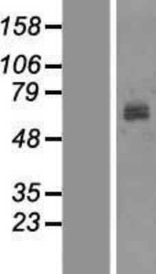 Western Blot: Tyrosinase Overexpression Lysate [NBP2-10667]