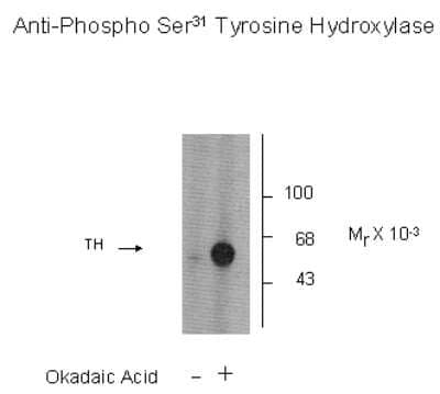 Western Blot: Tyrosine Hydroxylase [p Ser31] Antibody [NB300-211]