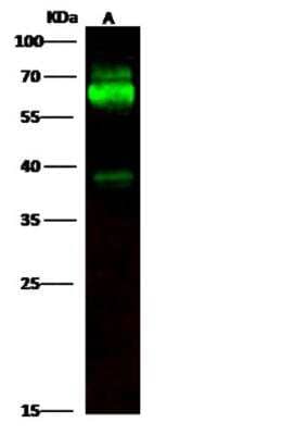 Western Blot: Tyrosine Hydroxylase Antibody (001) [NBP2-90761]