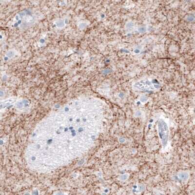 Immunohistochemistry: Tyrosine Hydroxylase Antibody (CL3049) [NBP2-46647]