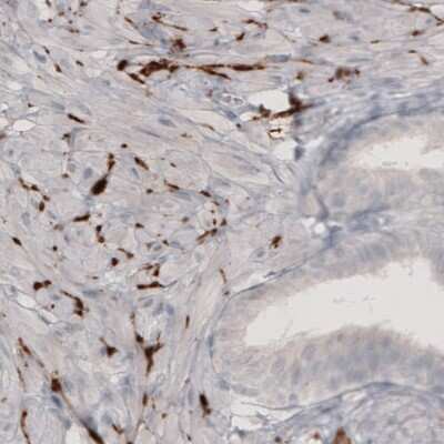 Immunohistochemistry: Tyrosine Hydroxylase Antibody (CL3049) [NBP2-46647]