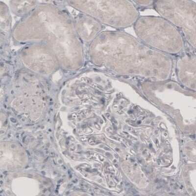 Immunohistochemistry: Tyrosine Hydroxylase Antibody (CL3049) [NBP2-46647]