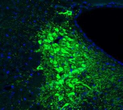 Immunohistochemistry: Tyrosine Hydroxylase Antibody (CL3049) [NBP2-46647]