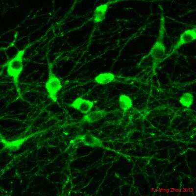 Immunofluorescent Detection of Tyrosine Hydroxylase in Mouse Neurons