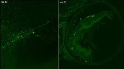Immunohistochemical Staining of Tyrosine Hydroxylase in Frozen Mouse Tissue