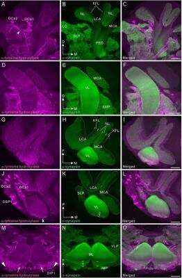 Immunohistochemical Detection of Tyrosine Hydroxylase in Cockroach Brain Tissue