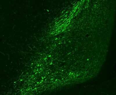 Immunohistochemistry: Tyrosine Hydroxylase Antibody [NB300-110]