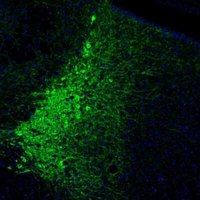 Immunohistochemistry: Tyrosine Hydroxylase Antibody [NBP2-38903]