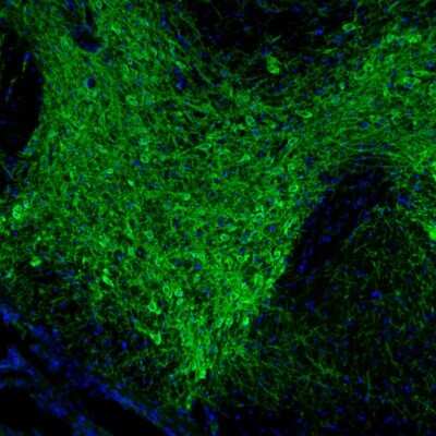 Immunohistochemistry: Tyrosine Hydroxylase Antibody [NBP2-38903]