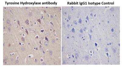 Immunohistochemical Staining of Tyrosine Hydroxylase in Paraffin Embedded Rat Brain