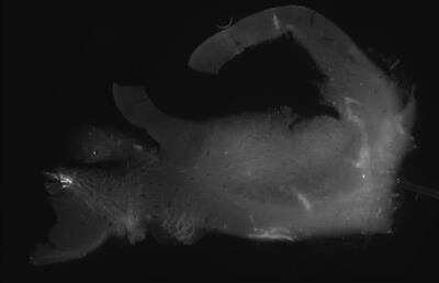 Immunohistochemistry-Paraffin: Tyrosine Hydroxylase Antibody [NB300-110]