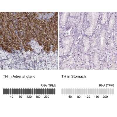 Immunohistochemistry-Paraffin: Tyrosine Hydroxylase Antibody [NBP2-38903]