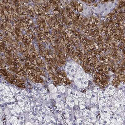 Immunohistochemistry-Paraffin: Tyrosine Hydroxylase Antibody [NBP2-38903]