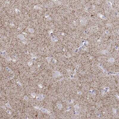 Immunohistochemistry-Paraffin: Tyrosine Hydroxylase Antibody [NBP2-38903]