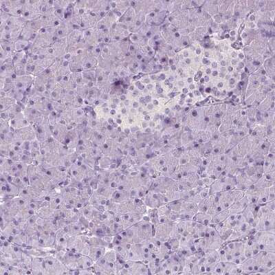 Immunohistochemistry-Paraffin: Tyrosine Hydroxylase Antibody [NBP2-38903]
