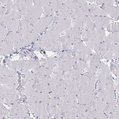 Immunohistochemistry-Paraffin: Tyrosine Hydroxylase Antibody [NBP2-38903]