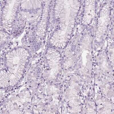 Immunohistochemistry-Paraffin: Tyrosine Hydroxylase Antibody [NBP2-38903]