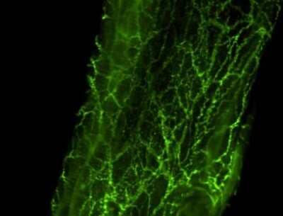 Fluorescent Staining of Tyrosine Hydroxylase in Whole Mount Rat Artery