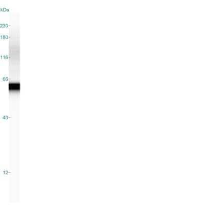 Detection of Tyrosine Hydroxylase in PC-12 Lysate Using Simple Western