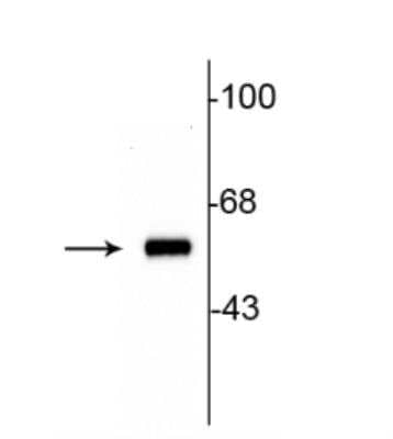 Detection of Tyrosine Hydroxylase in Rat Striatal Lysate in Western Blot