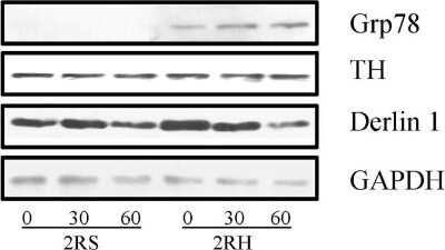 Detection of Tyrosine Hydroxylase in Two Groups of Rat Adrenal Gland Extracts