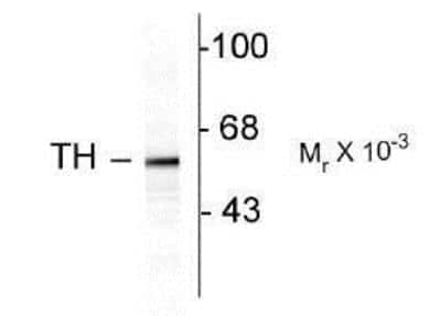 Western Blot: Tyrosine Hydroxylase Antibody [NB300-110]