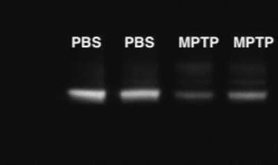 Western Blot: Tyrosine Hydroxylase Antibody [NB300-110]