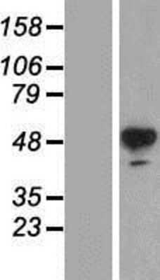 Western Blot: Tyrosine Hydroxylase Overexpression Lysate [NBP2-11149]