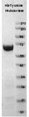SDS-PAGE: Recombinant Human Tyrosine Hydroxylase His Protein [NBP1-42461]