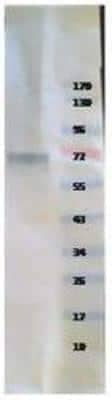 Western Blot: Recombinant Human Tyrosine Hydroxylase His Protein [NBP1-42461]