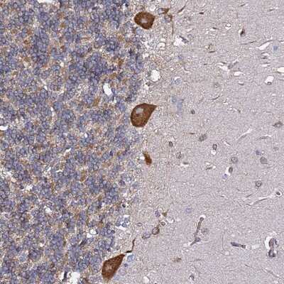 Immunohistochemistry-Paraffin: Tyrosylprotein Sulfotransferase 1/TPST1 Antibody [NBP1-92525]