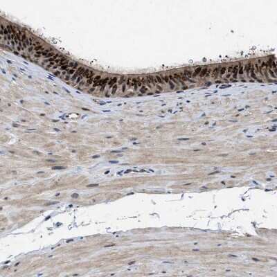 Immunohistochemistry-Paraffin: Tyrosylprotein Sulfotransferase 2/TPST2 Antibody [NBP1-86023]