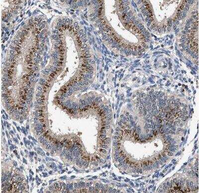Immunohistochemistry-Paraffin: Tyrosylprotein Sulfotransferase 2/TPST2 Antibody [NBP1-86023]