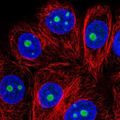 Immunocytochemistry/ Immunofluorescence: U11/U12-35K Antibody [NBP2-56203]