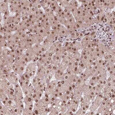 Immunohistochemistry: U11/U12-35K Antibody [NBP2-39082]