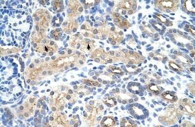 Immunohistochemistry-Paraffin: U11/U12-35K Antibody [NBP1-57499]