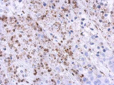 Immunohistochemistry-Paraffin: U11/U12-35K Antibody [NBP2-20774]