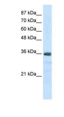 Western Blot: U11/U12-35K Antibody [NBP1-57499]