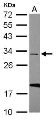 Western Blot: U11/U12-35K Antibody [NBP2-20774]
