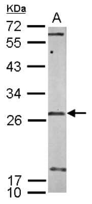 Western Blot: U11/U12-35K Antibody [NBP2-20774]