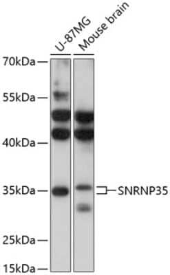 Western Blot: U11/U12-35K AntibodyAzide and BSA Free [NBP2-93775]