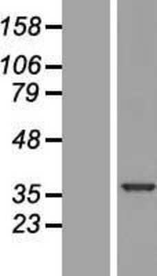 Western Blot: U11/U12-35K Overexpression Lysate [NBP2-04941]